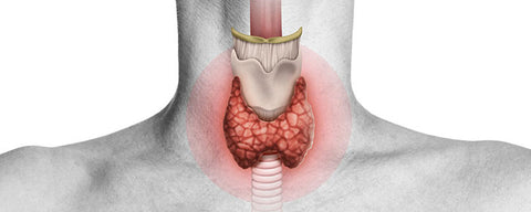 Thyroid eye disease